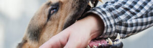 If you or someone you love has suffered a dog bite in Washington, D.C., it is important to understand your legal rights and options.