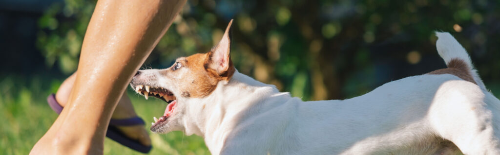 A dog bite can leave lasting physical, emotional, and financial consequences. While some attacks result in relatively minor injuries, others lead to infections, permanent scarring, nerve damage, or emotional trauma that requires months or even years of recovery. If you were bitten by someone else's dog in Washington, DC, you may be wondering whether you have the right to pursue compensation. Personal injury claims involving dog bites can help injured victims recover damages for medical expenses, lost income, pain and suffering, and other losses. Understanding how these claims work can help you make informed decisions after an attack.